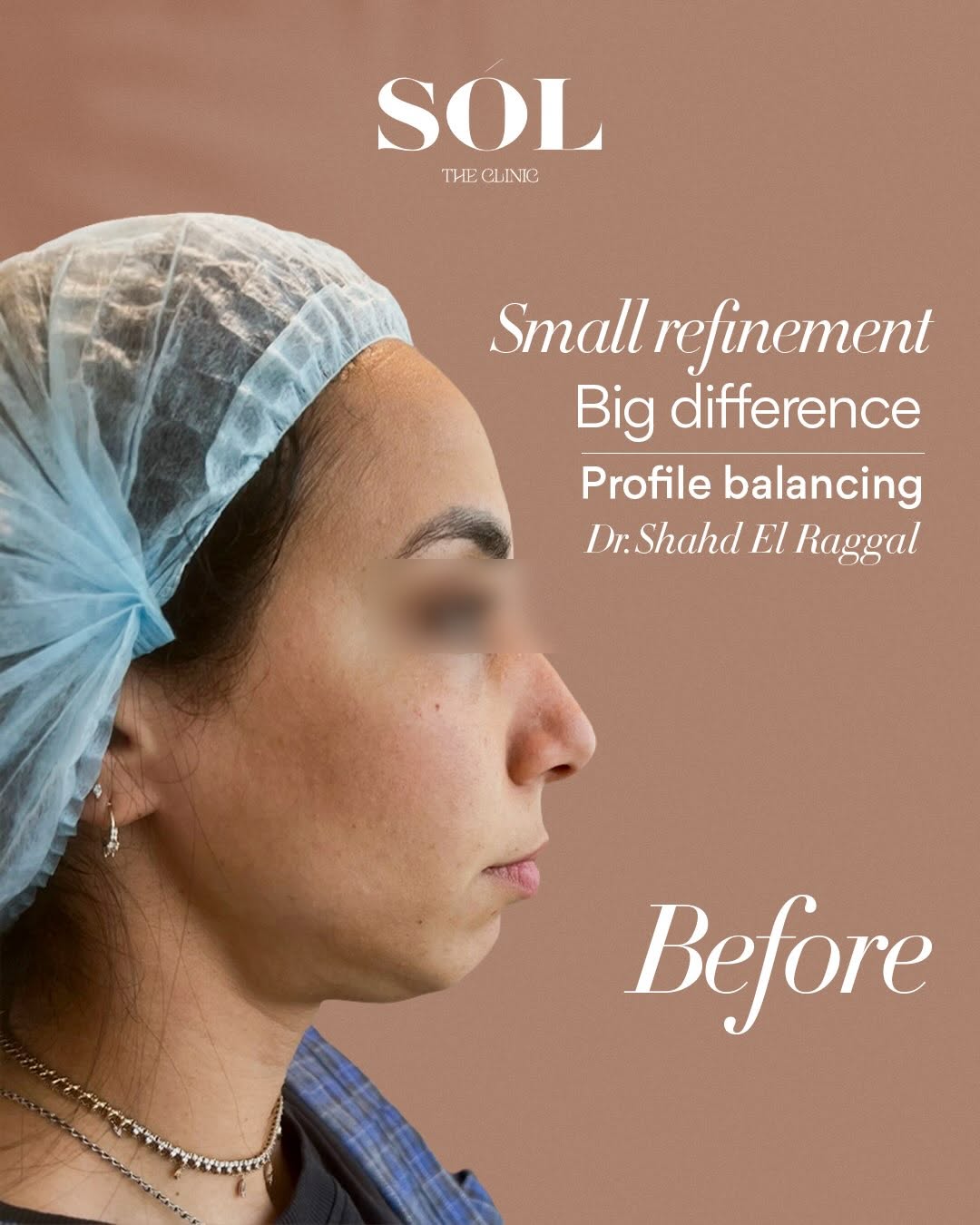 Profile balancing consultation before photo at SÓL